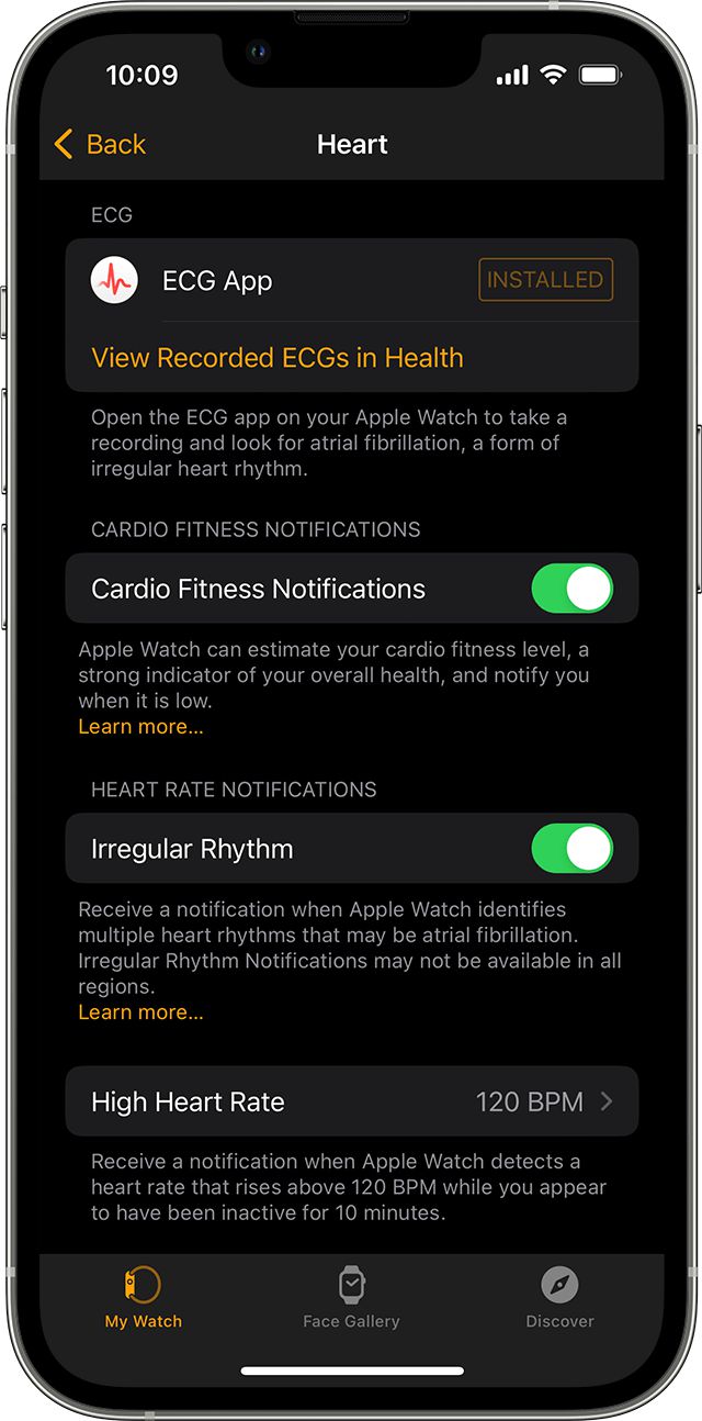 从健康监测到生命守护:Apple Watch科技创新与人文关怀交织的十年(图5)